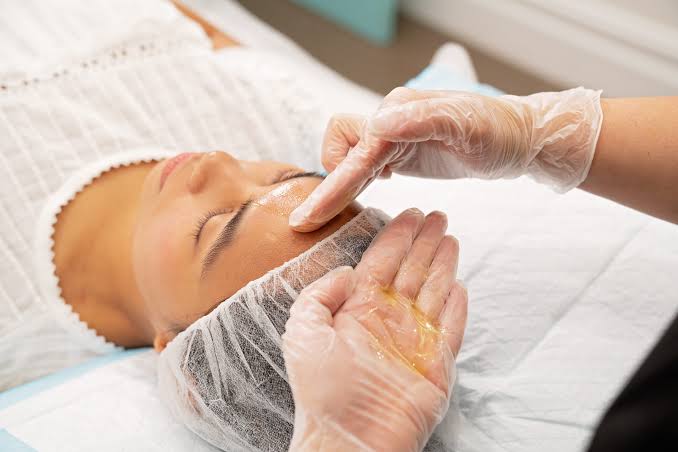 Chemical Peels Explained: Which Peel Is Best for You?