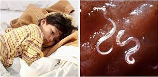 Namun, tentu saja akan lebih baik jika kamu. Waktu Sesuai Beri Anak Makan Ubat Cacing Untuk Elak Parasit Berkampung