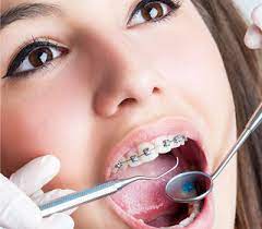 It takes tom 20 minutes to get to work in the morning. How Long Do I Have To Wear Braces Brace Place Orthodontics