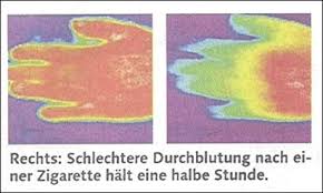 Wie Lange Dauert Es Bis Die Blutgefasse Wieder Ausweiten Nach Dem Rauchen Menschen Nikotin