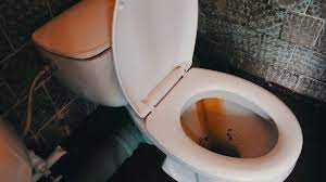 Lavabo ve klozetteki sarı lekeler nasıl çıkar. Tuvaleti Pastan Nasil Temizleyebilirim Temizleme Ve Onleme Yontemleri Tuvalet Ve Sarnictaki Pasin Nasil Yikandigi