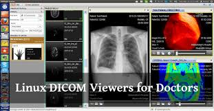 You can download free dicom software. Top 11 Free Linux Dicom Viewers For Doctors