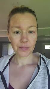 Does it get easier? Getting my bite where it needs to be, closing up extra  spaces in upper teeth and making room for the crowding in my lower teeth.  #teethaligners #fixingmyteeth