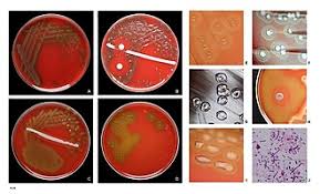 Image result for Penicillin Resistant Pneumococcus