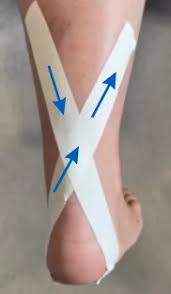 Image result for Taping for Soleus and Achilles