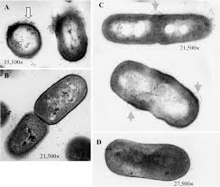 Listeria monocytogenes is the species of pathogenic bacteria that causes the infection listeriosis.it is a facultative anaerobic bacterium, capable of surviving in the presence or absence of oxygen. Transmission Electron Microscopy Of Listeria Monocytogenes Wt And A572 Download Scientific Diagram