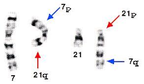 Ort) versteht man in der genetik eine chromosomenmutation, bei der chromosomenabschnitte an eine andere position innerhalb des chromosomenbestandes verlagert. Leona E V Familienselbsthilfe Bei Seltenen Chromosomenveranderungen Einfuhrung Zu Chromosomen Storungen