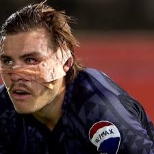 Aidan Morgan's face bandage will go down in history! Cheers to KFC for  delivering our Sky Sport NZ Super Rugby coverage!