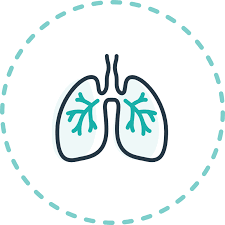 Image result for Mild Persistent Asthma