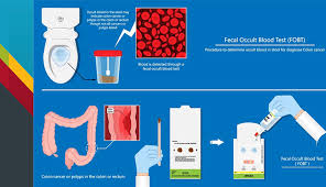 Image result for Colorectal Cancer Screening