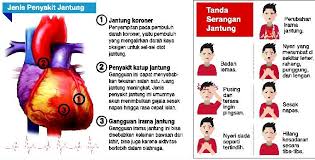 Penyakit jantung koroner adalah penyempitan pada pembuluh darah penyakit jantung juga bisa disebabkan kelainan yang dibawa sejak lahir. Menko Pmk Prevalensi Penyakit Jantung Terus Meningkat