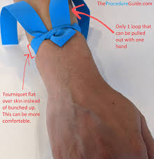 Image result for Peripheral IV Access