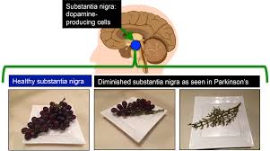 Complementary And Alternative Medicine Cam In Parkinson S Journey With Parkinson S