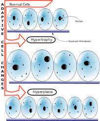 Hypertrophy Meaning In Marathi