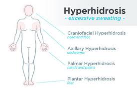 Image result for Hyperhidrosis Causes