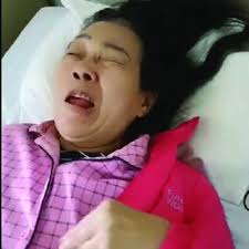 Left faciobrachial dystonic seizure.