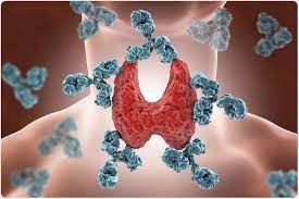 Negli individui con una malattia autoimmune, infatti, gli. Opzioni Di Trattamento Per La Malattia Autoimmune