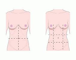The human abdomen is divided into quadrants and regions by anatomists and physicians for the purposes of study, diagnosis, and treatment. Game Statistics Anatomy Quadrants Regions