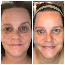 I love faces that have freckles. I love faces that have wrinkles. For me,  beauty is naturalism, I guess.