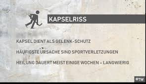 In seltenen fällen treten schmerzen und kribbeln am ganzen finger bzw. Doktorweigl Erklart Kapselriss An Finger Daumen Hand
