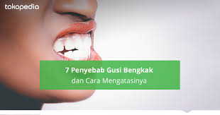 7 Penyebab Cara Mengatasi Gusi Bengkak Tokopedia Blog