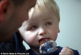 Baby boy has opened his eyes for the first time aged 17 months