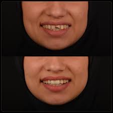 köşker diş kliniği