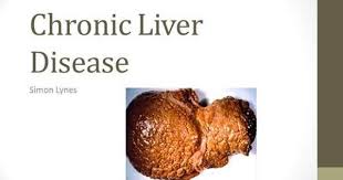 Chronic Liver Disease Simon Lynes Definition Progressive Destruction And Regeneration Of The Liver Parenchyma Leading To Fibro Liver Disease Cirrhosis Disease