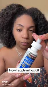 Minoxidil for Hair Growth: Effective Solutions and Tips