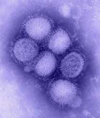 swine influenza wikipedia