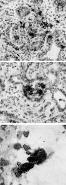 Tidak puas di kantor pln, warga yang sudah kesal juga mendatangi kantor pltd milik pln, kemudian kembali merusak gedung tersebut. Immune Cell Differentiation In Mammary Gland Tissues And Milk Of Cows Chronically Infected With Staphylococcus Aureus Leitner 2003 Journal Of Veterinary Medicine Series B Wiley Online Library