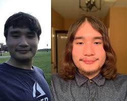 I had moved on to a drug called taxol which typically causes hair loss also, but not as much as the adriamycin. About 15 Months Of Hair Growth Fierceflow