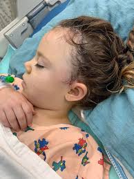 Successful Craniotomy Surgery for AVM Recovery