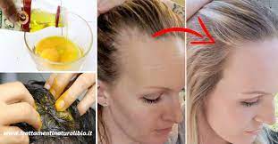 Se applicato con frequenza, dona idratazione, lucentezza, . Come Usare L Uovo Per Bloccare La Caduta Dei Capelli E Accelerarne La Crescita