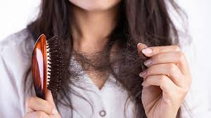 Everyday Habits That Will Help Prevent Hair Loss Prevent Hair Loss Slow Hair Loss Diffuse Hair Loss