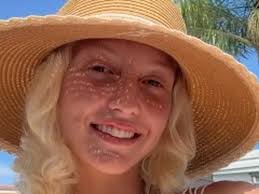 Fundraiser by Rhea Witholt : Support Kaya's Recovery After Train Accident