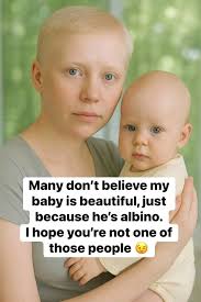 That baby looks just like her daddy” Yep, she does, it's like I cloned him.  The same nose. The same eyes. The same smile. Even the same little facial  expressions that say