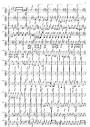 Symphony No. 9 Mvt. 3: Rondo. Burleske Sheet Music - Symphony No ...