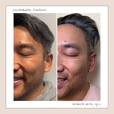 Elizabeth Barte, NP-C 💉 𝐃𝐚𝐥𝐥𝐚𝐬 𝐈𝐧𝐣𝐞𝐜𝐭𝐨𝐫 (@eliz.np) •  Instagram photos and videos