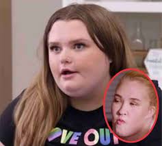 A New Chapter! 💪 Mama June's Alana — Gives A "Major" Update On Her Nursing  Journey In Denver After The Scary Crash!!