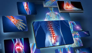 Sports injuries are commonly caused by overuse, direct impact, or the application of force that is greater common injuries include bruises, sprains, strains, joint injuries and nose bleeds. Sports Injuries Sprains Soft Tissue Injuries Bradley Physio