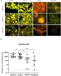 Sometimes the glue on rubber must be removed, or glue accidentally falls onto rubber that was not supposed to be glued. Engineered Phage Endolysin Eliminates Gardnerella In Bacterial Vaginosis Without Damaging The Healthy Vaginal Microbiome Medrxiv