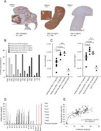Hepatitis c is a liver infection caused by the hepatitis c virus (hcv). Functional And Biochemical Characterization Of Hepatitis C Virus Hcv Particles Produced In A Humanized Liver Mouse Model Journal Of Biological Chemistry