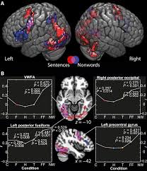You just need to fix the mistakes in the picture. Learning To Read Recycles Visual Cortical Networks Without Destruction Science Advances