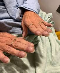 Image result for Digital Clubbing