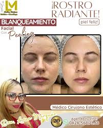 Qué esperás para agendar tu cita 📲 0424-568.73.68 👩🏼‍⚕️Dra. Lorna Marquez  ⚕️ Médico Cirujano Estético-Obesologo ⚕️Barquisimeto