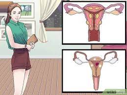 Vaginalzysten Behandeln 11 Schritte Mit Bildern Wikihow