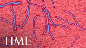 Ebola virus and marburg virus live in animal hosts. Three People In Uganda Died From The Marburg Virus How It S Similar To Ebola Virus Time Youtube