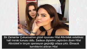 İşte hilal altınbilek'i̇n estetiksiz hali. Cukurova Nin Zulayha Si Estetik Harikasiymis Hilal Altinbilek Eski Haline Bakin Video Dailymotion