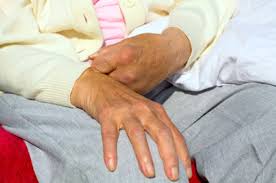 Risken att åter drabbas av blodpropp är fem till tio procent under det första året, därefter cirka fem procent per år. Varningstecken Pa Stroke Stroke Se